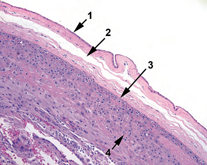 外科病理学实践：诊断过程的初学者指南 ｜ 第18章 胎盘（Placenta）