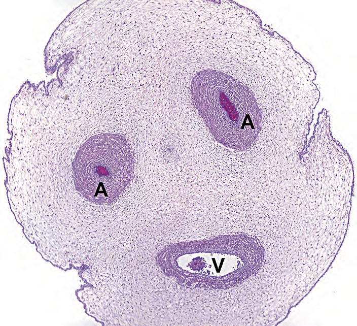 外科病理学实践：诊断过程的初学者指南 | 第18章 胎盘（Placenta）