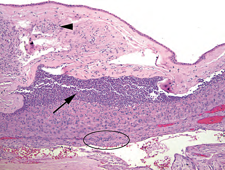 外科病理学实践：诊断过程的初学者指南 | 第18章 胎盘（Placenta）