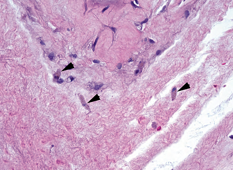 外科病理学实践：诊断过程的初学者指南 | 第18章 胎盘（Placenta）